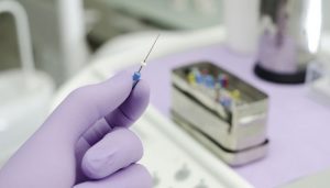 Endodonzia