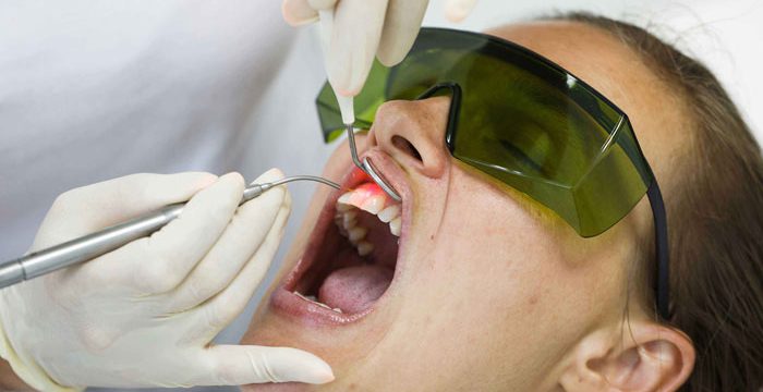 Odontoiatria laser